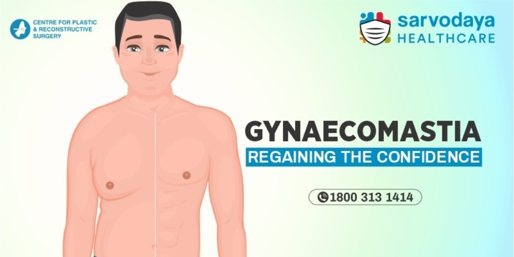 Gynaecomastia; Regaining the Confidence